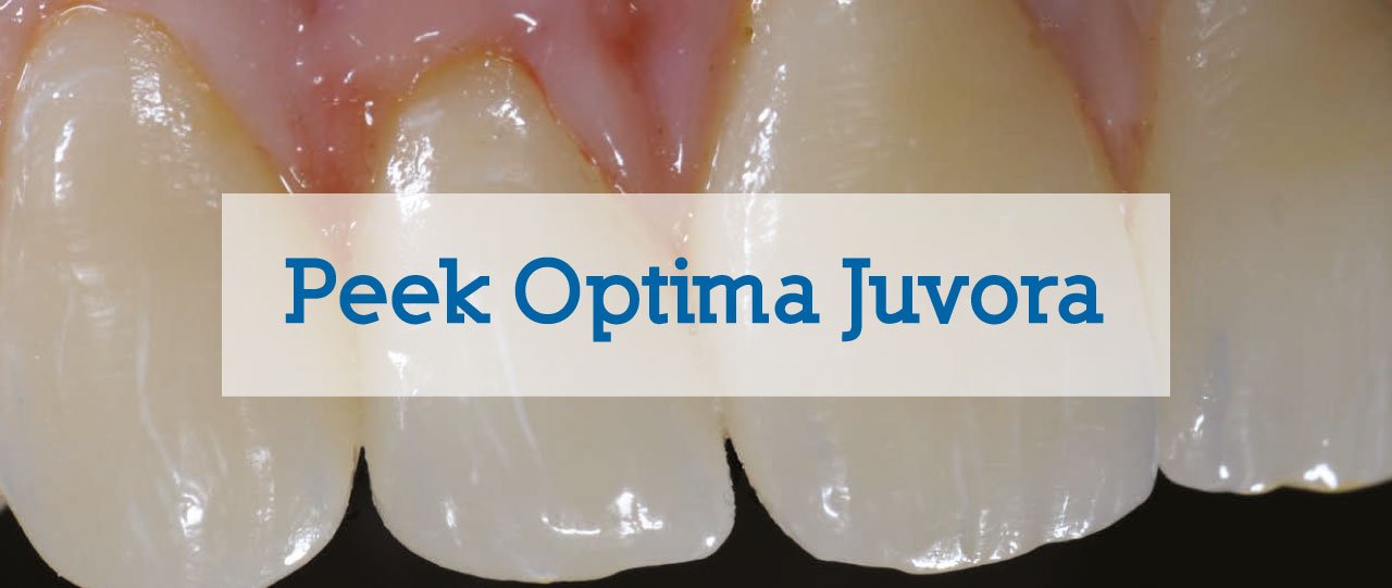 Articolo su Peek Optima di Juvora